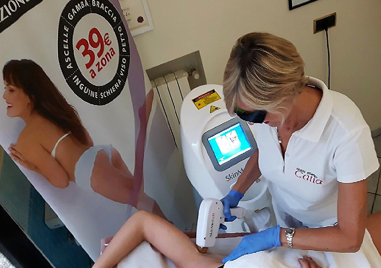 trattamenti laser